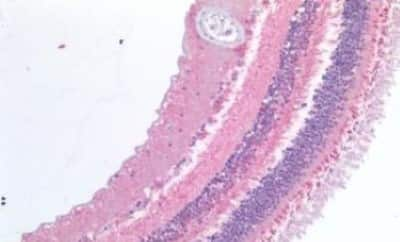 Immunohistochemistry-Paraffin: ABCA4 Antibody [NBP3-14528] - Human Retina: Formalin-Fixed, Paraffin-Embedded (FFPE)